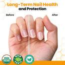 Óleo revitalizante antifúngico para unhas com veneno de abelha.