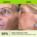 Creme firmador e antirrugas Rolimey® Botox & Vita-A Retinol Shot - Último dia da promoção com 70% de desconto