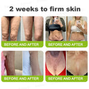 Creme firmador e antirrugas Rolimey® Botox & Vita-A Retinol Shot - Último dia da promoção com 70% de desconto