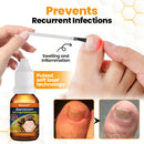 Óleo revitalizante antifúngico para unhas com veneno de abelha.